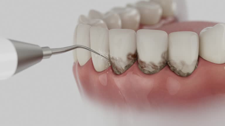 Trusted Teeth Cleaning And Checkup service in Uniontown, OH - Dentist Open Now